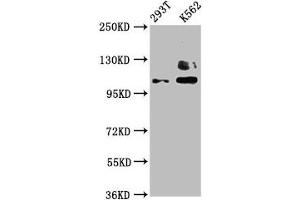Western Blot Positive WB detected in: 293T whole cell lysate, K562 whole cell lysate All lanes: ZNF268 antibody at 4 μg/mL Secondary Goat polyclonal to rabbit IgG at 1/50000 dilution Predicted band size: 109, 90, 10, 12, 16, 6, 13 kDa Observed band size: 109 kDa (ZNF268 anticorps  (AA 416-603))