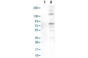 Western Blot analysis of Lane 1: negative control (vector only transfected HEK293T cell lysate) and Lane 2: over-expression lysate (co-expressed with a C-terminal myc-DDK tag in mammalian HEK293T cells) with ACSL5 monoclonal antibody, clone CL0275 . (ACSL5 anticorps)