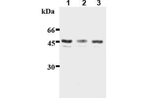 Western Blotting (WB) image for anti-Inhibitor of kappa Light Polypeptide Gene Enhancer in B-Cells, Kinase gamma (IKBKG) (AA 61-137) antibody (ABIN567773) (IKBKG anticorps  (AA 61-137))