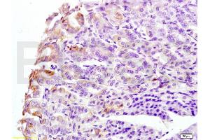 Formalin-fixed and mouse stomach tissue labeled with Anti-CK8 Polyclonal Antibody, Unconjugated (ABIN737751) at 1:200 followed by conjugation to the secondary antibody and DAB staining