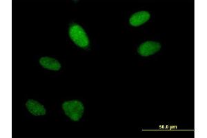 Immunofluorescence of purified MaxPab antibody to FLJ10154 on HeLa cell. (ARGLU1 anticorps  (AA 1-273))
