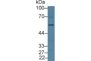 Western blot analysis of Rat Liver lysate, using Rat DRD2 Antibody (2 µg/ml) and HRP-conjugated Goat Anti-Rabbit antibody ( (Dopamine d2 Receptor anticorps  (AA 194-421))