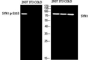 Western Blot (WB) analysis of 293T 3T3 COLO205 using SYN1 antibody. (SYN1 anticorps)