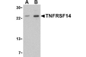Image no. 1 for anti-Tumor Necrosis Factor Receptor Superfamily, Member 14 (TNFRSF14) (N-Term) antibody (ABIN265160) (HVEM anticorps  (N-Term))