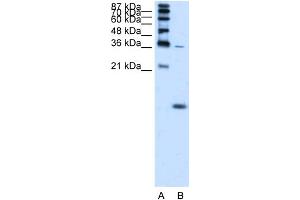 WB Suggested Anti-HBZ Antibody Titration:  1.