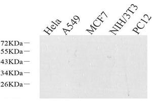 Western Blot analysis of various samples using S100A4 Polyclonal Antibody at dilution of 1:600. (s100a4 anticorps)