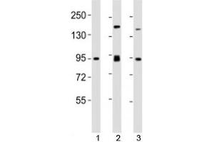 Western blot testing of SUZ12 antibody at 1:2000 dilution. (SUZ12 anticorps  (AA 375-408))