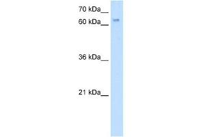 WB Suggested Anti-RBM35A Antibody Titration:  5. (ESRP1 anticorps  (N-Term))