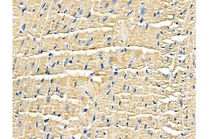 ABIN6259653 and ABIN6266917 at 1/100 staining Rat heart tissue by IHC-P. (Serotonin Receptor 5A anticorps  (Internal Region))