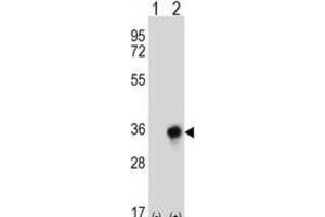 Western Blotting (WB) image for anti-Carbonyl Reductase 3 (CBR3) antibody (ABIN2997011) (CBR3 anticorps)