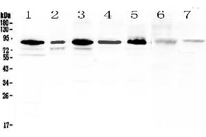 Western blot analysis of MED15 using anti-MED15 antibody . (MED15 anticorps  (AA 1-285))