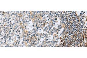 Immunohistochemistry of paraffin-embedded Human tonsil tissue using GLS Polyclonal Antibody at dilution of 1:70(x200)