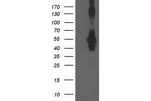 Western Blotting (WB) image for anti-Cerebral Cavernous Malformation 2 (CCM2) antibody (ABIN1497136) (CCM2 anticorps)