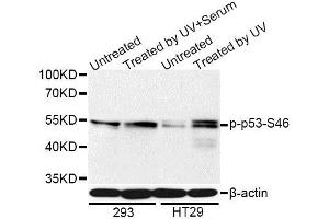 Western blot analysis of extracts of 293 and HT-29 cells, using Phospho-p53-S46 antibody (ABIN5969969) at 1/1000 dilution. (p53 anticorps  (pSer46))