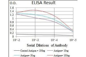 Black line: Control Antigen (100 ng), Purple line: Antigen(10 ng), Blue line: Antigen (50 ng), Red line: Antigen (100 ng),