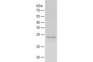 Western Blotting (WB) image for Actinin, alpha 1 (ACTN1) (AA 1-249) protein (His tag) (ABIN7121800)