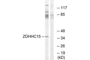 Western Blotting (WB) image for anti-Zinc Finger, DHHC-Type Containing 15 (ZDHHC15) (C-Term) antibody (ABIN1851772) (ZDHHC15 anticorps  (C-Term))