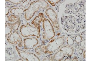 Immunoperoxidase of monoclonal antibody to TAOK2 on formalin-fixed paraffin-embedded human kidney.