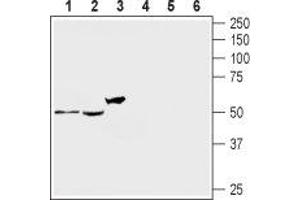 Western blot analysis of rat DRG (lanes 1 and 4), mouse brain (lanes 2 and 5) and human brain neuroblastoma SH-SY5Y (lanes 3 and 6) lysates: - 1-3. (HTR2A anticorps  (Extracellular, N-Term))