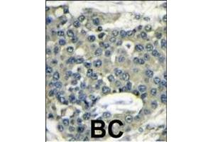 anti-Eukaryotic Translation Initiation Factor 4B (EIF4B) (AA 546-575), (C-Term) antibody