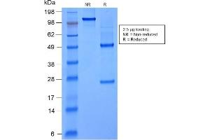 SDS-PAGE Analysis Purified FOXA1 Mouse Recombinant Monoclonal Antibody (rFOXA1/1515). (Recombinant FOXA1 anticorps  (AA 372-472))
