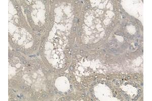 ABIN6265846 and ABIN6272476 at 1/100 staining human normal kidney tissue by IHC-P.
