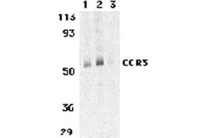 Image no. 2 for anti-Chemokine (C-C Motif) Receptor 3 (CCR3) (C-Term) antibody (ABIN205726) (CCR3 anticorps  (C-Term))