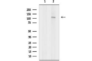 anti-Teashirt Zinc Finger Homeobox 1 (TSHZ1) (Internal Region) antibody