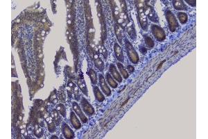 IHC analysis of NRF1 using anti-NRF1 antibody (ABIN6719347).