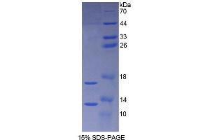 SDS-PAGE analysis of Rat Synuclein alpha Protein. (SNCA Protéine)