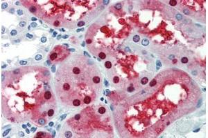 Human Kidney (formalin-fixed, paraffin-embedded) stained with GATA3 antibody ABIN462169 followed by biotinylated goat anti-rabbit IgG secondary antibody ABIN481713, alkaline phosphatase-streptavidin and chromogen. (GATA3 anticorps  (AA 36-85))