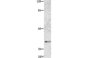 Western blot analysis of Jurkat cell, using PTGER1 Polyclonal Antibody at dilution of 1:500 (PTGER1 anticorps)