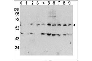 Western blot analysis of phospho c-Myc antibody and human TPA activated HeLa cells/lysate (0: without TPA; 1: 60ug/ml TPA-15min; 2: 60ug/ml-30min; 3: 60ug/ml-45min; 4: 125ug/ml-15min; 5: 125ug/ml-30min; 6: 125ug/ml-45min; 7: 250ug/ml-15min; 8: 250ug/ml-30 (c-MYC anticorps  (pThr58))