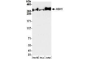 Western Blotting (WB) image for anti-Achaete-Scute Complex Homolog 1 (Drosophila) (ASCL1) (AA 2919-2969) antibody (ABIN7453478)