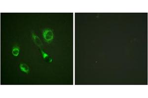 Immunofluorescence analysis of HeLa cells, using EPHA2/3/4 (Phospho-Tyr588/596) antibody. (EPHA2/3 anticorps  (pTyr588, pTyr596))