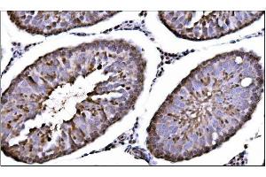 IHC analysis of CAMKIV/Camk4 using anti-CAMKIV/Camk4 antibody (ABIN7600419). (CAMK4 anticorps  (AA 19-469))