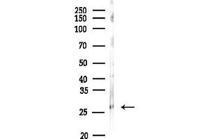 Western blot analysis of lysates from MDA-MB-231 cells(heat-shock,45 min treatment), using Hemoglobin subunit alpha Antibody at 1/1000 dilution.