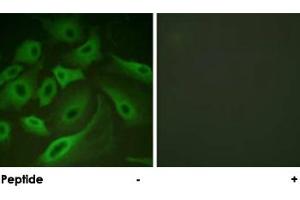 Immunofluorescence analysis of HeLa cells, using PLN polyclonal antibody .