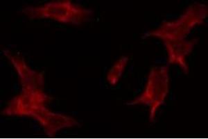 ABIN6274515 staining HuvEc by IF/ICC.