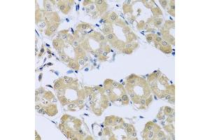 Immunohistochemistry of paraffin-embedded human stomach using SYT4 antibody (ABIN6129135, ABIN6148791, ABIN6148792 and ABIN6223676) at dilution of 1:100 (40x lens). (SYT4 anticorps  (AA 38-190))