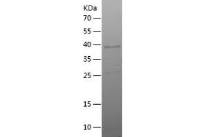 Western Blotting (WB) image for Glycophorin C (GYPC) (AA 1-128) protein (His-IF2DI Tag) (ABIN7123166)