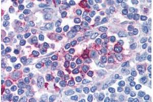 Anti-FPR1 antibody  ABIN1048604 IHC staining of human lymph node. (FPR1 anticorps  (C-Term))