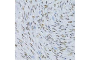 Immunohistochemistry of paraffin-embedded human uterus using SNRNP70 antibody.