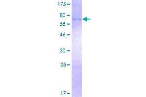 Image no. 1 for Ferrochelatase (FECH) (AA 1-423) protein (GST tag) (ABIN1353943)