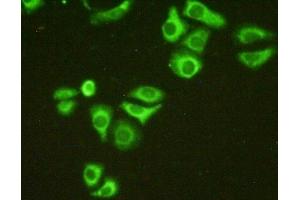 Detection of C1QBP in Hela cells using Polyclonal Antibody to Complement component 1 Q subcomponent-binding protein, mitochondrial (C1QBP)