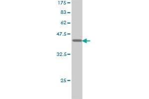 Western Blot detection against Immunogen (38.