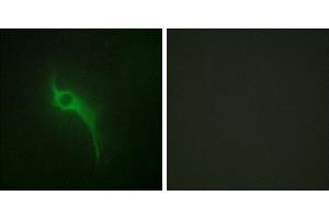 Peptide - +Immunofluorescence analysis of HeLa cells, using Collagen V α1 antibody. (COL5A1 anticorps)