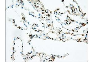 Image no. 7 for anti-Basigin (Ok Blood Group) (BSG) antibody (ABIN1498015) (CD147 anticorps)