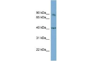 WB Suggested Anti-NFATC1 Antibody Titration:  0. (NFATC1 anticorps  (Middle Region))