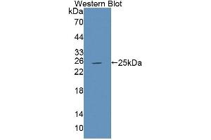 Western blot analysis of the recombinant protein. (PTPRU anticorps  (AA 1263-1446))